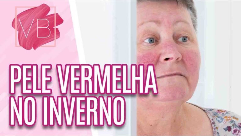 Desvendando os segredos da pele vermelha na cara: Causas, tratamentos e prevenção