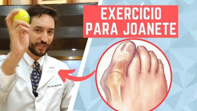 Joanetes inflamados: descubra o tratamento eficaz em 70 caracteres