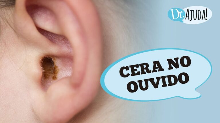 Causas e soluções para o acúmulo excessivo de cera no ouvido