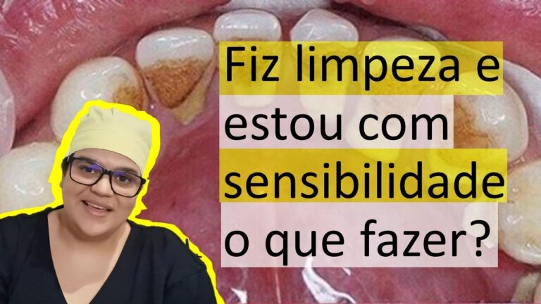 P&oacute;s-limpeza dental: o que comer para manter um sorriso saud&aacute;vel