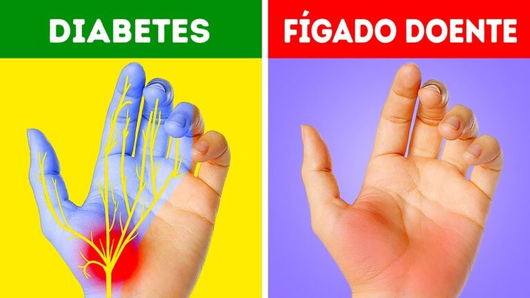 Descubra como tratar as gretas nas pontas dos dedos de forma eficaz!