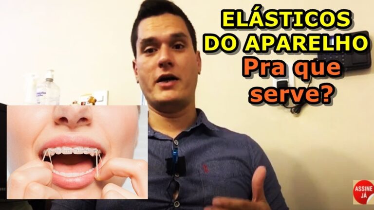 Descubra a utilidade do elástico no aparelho: benefícios e dicas!