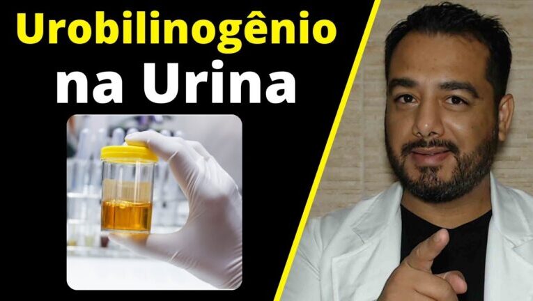 Descubra tudo sobre o urobilinogênio na urina: o que é e por que 0.2 é importante!