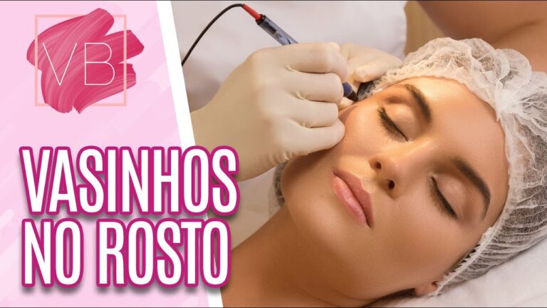 Derrames na cara: causas, tratamentos e preven&ccedil;&atilde;o