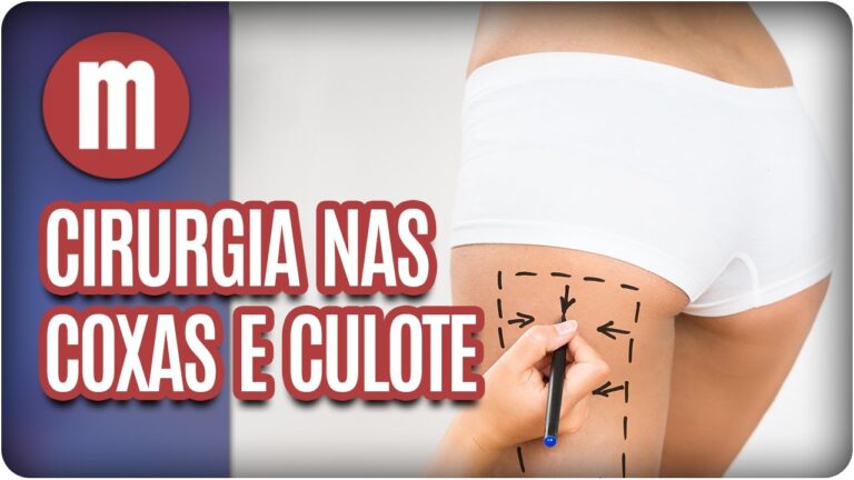 Fotos de cirurgia plástica nas pernas: Antes e Depois